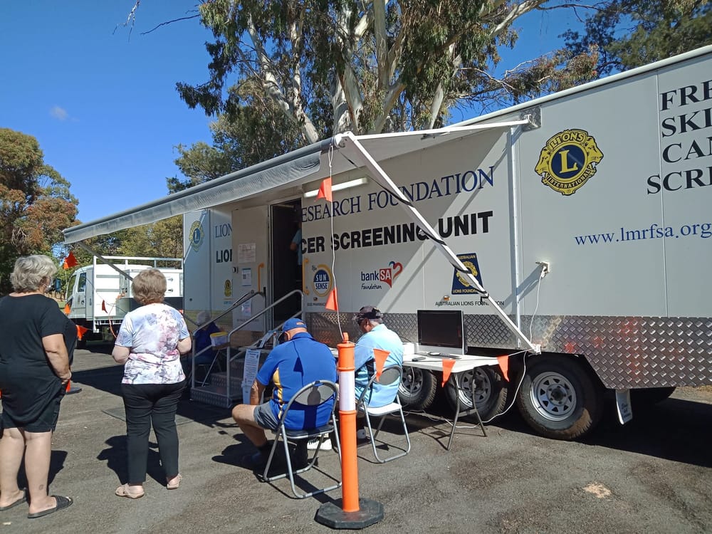 Skin cancer van catches cases early post image