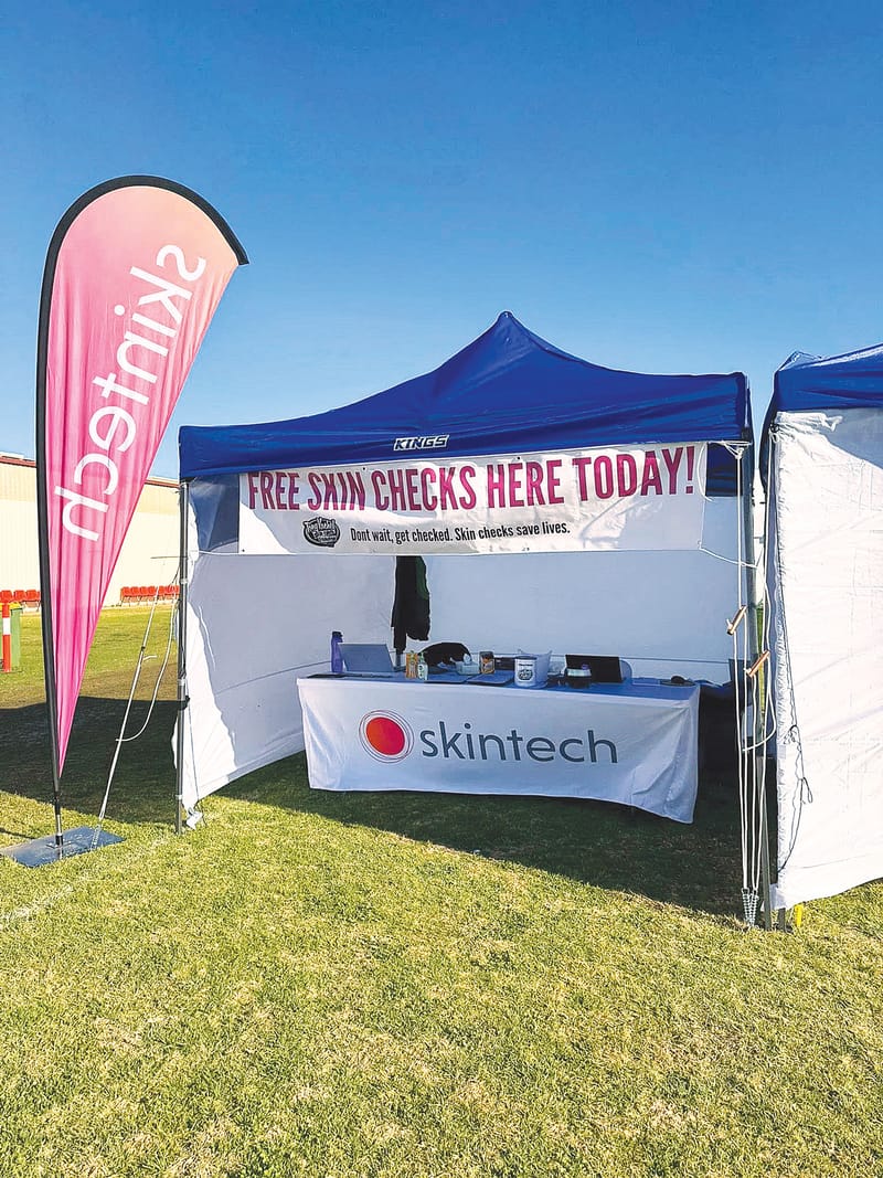 ‘Scary’ skin cancer check results from Field Days post image